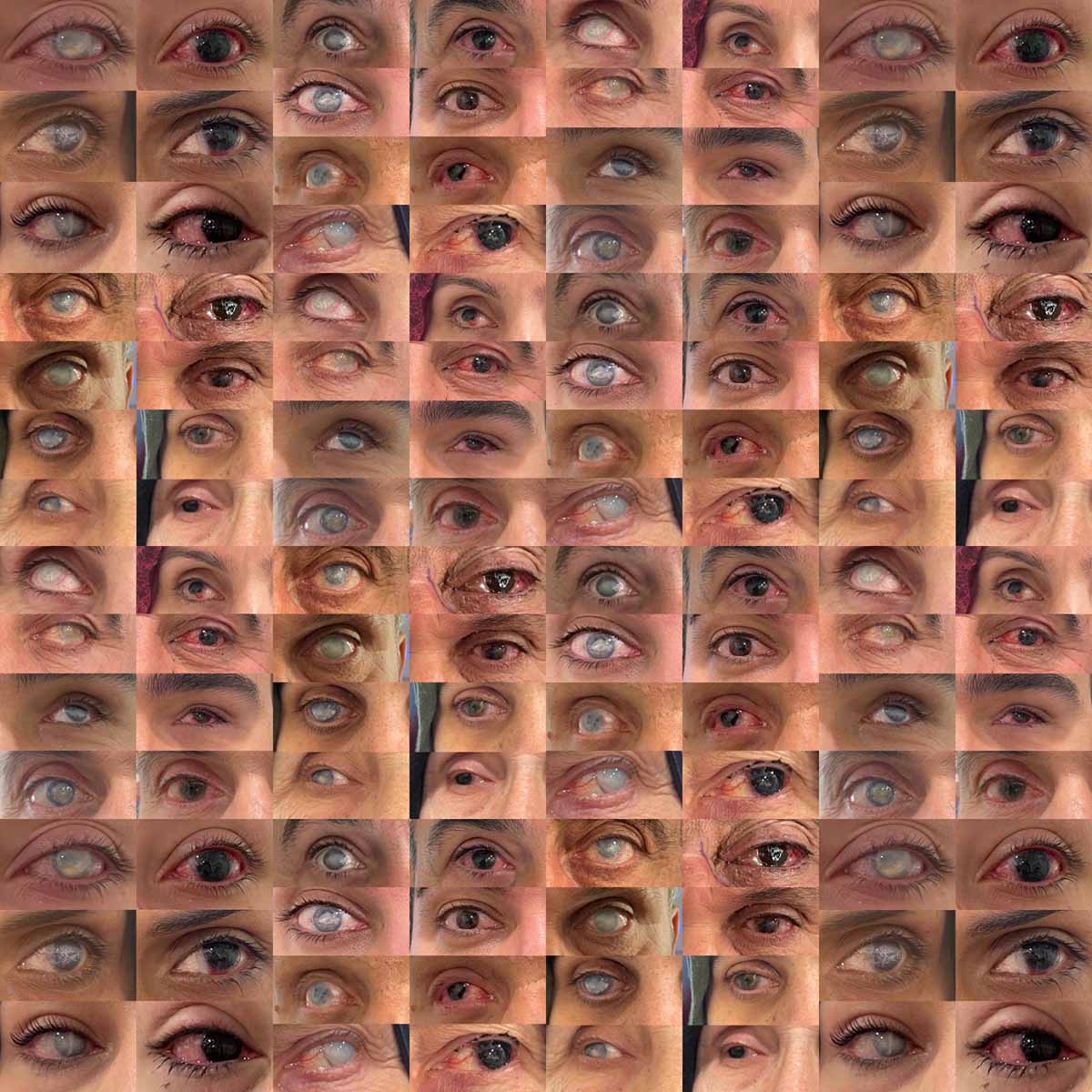 göz dövmesi nedir??, Göz Dövmesi nasıl yapılır